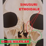 CE SUNT SINUSURILE