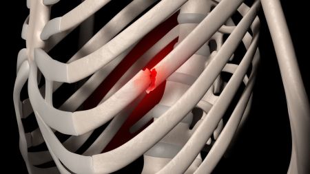 COASTE RUPTE … DIN PREA MULTĂ DRAGOSTE.