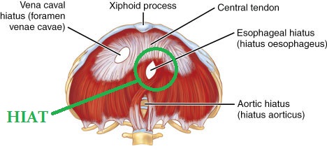 despre hernia hiatala