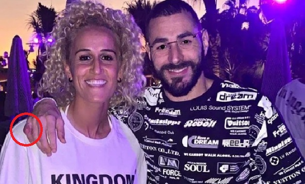 KARIM BENZEMA SI AL SAU DEGET ÎN CIOCAN