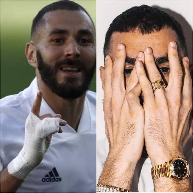 CIUDATUL DEGET ÎN CIOCAN AL LUI KARIM BENZEMA