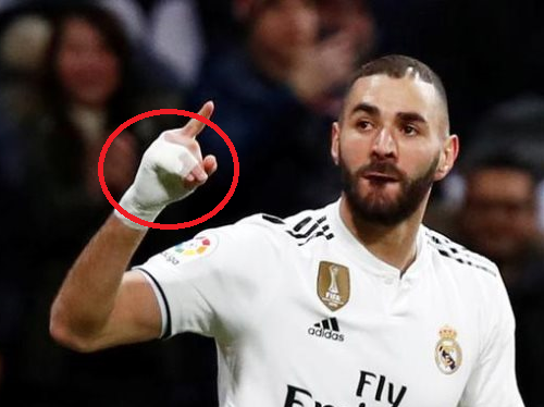 KARIM BENZEMA