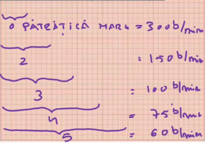INTERPRETAREA UNEI ELECTROCARDIOGRAME