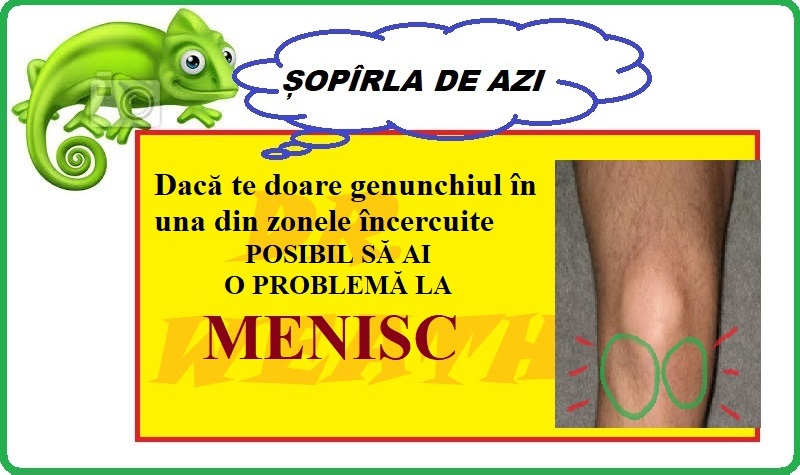 MENISCUL RUPT DURERE