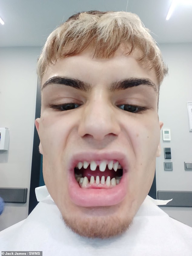 FATETE DENTARE