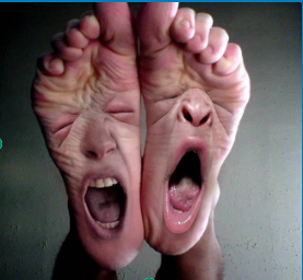 PICIORUL DIABETIC 1 – UN PICIOR SUPĂRAT