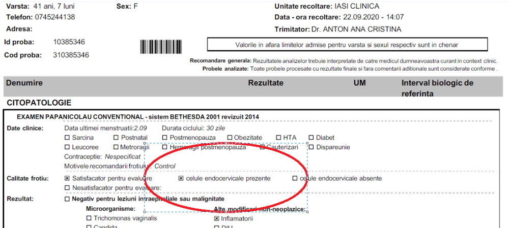 CELULE ENDOCERVICALE PREZENTE - E DE BINE SAU DE RĂU?
