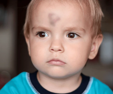 CAPUL SPART ȘI CUCUI ÎN FRUNTE 2 – TRATAMENT