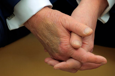 TRUMP MÂNĂ VÂNĂTĂ